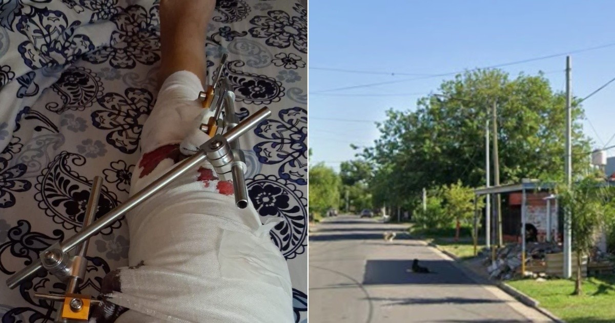 Jubilada atacada por una jauría en San Lorenzo quedó con fractura de tibia