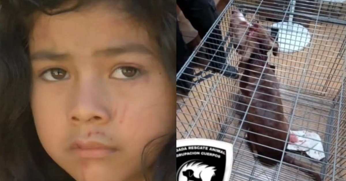 Nena de 6 años atacada por pitbull en Los Pumitas fue dada de alta y volvió a su casa